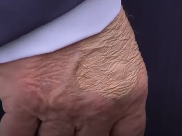 策略资本 特朗普回应“去世”传言